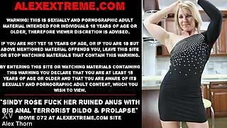 OMG! Sindy Rose Fucks Ruined Anus with Huge Terrorist Dildo and Prolapse!  