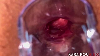 Anal Vision Speculum Gaping Huge Hairy Ass In Mature Homemade Action